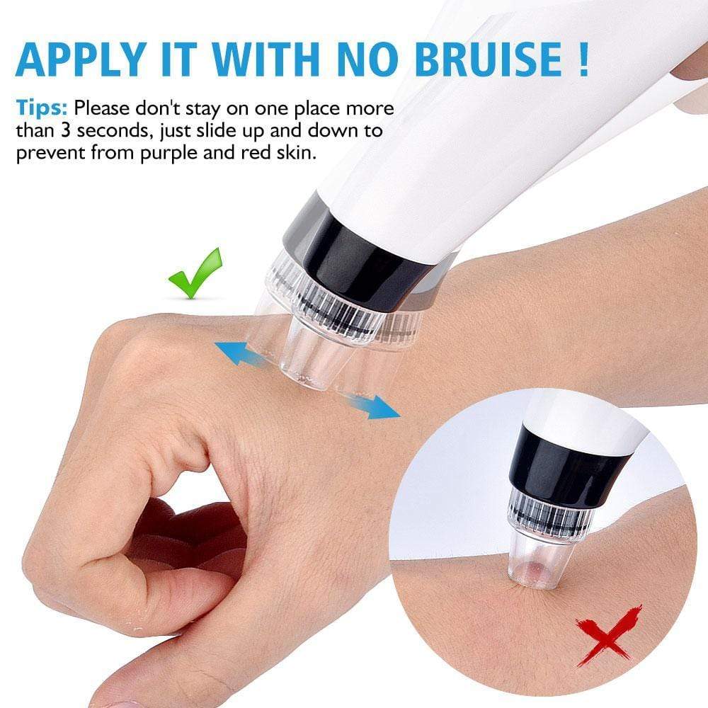 Vacuum Blackhead Remover