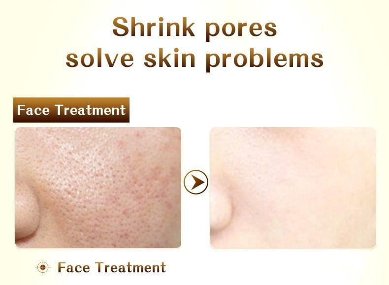 Hyaluronic Acid Intensive Skin Care Serum