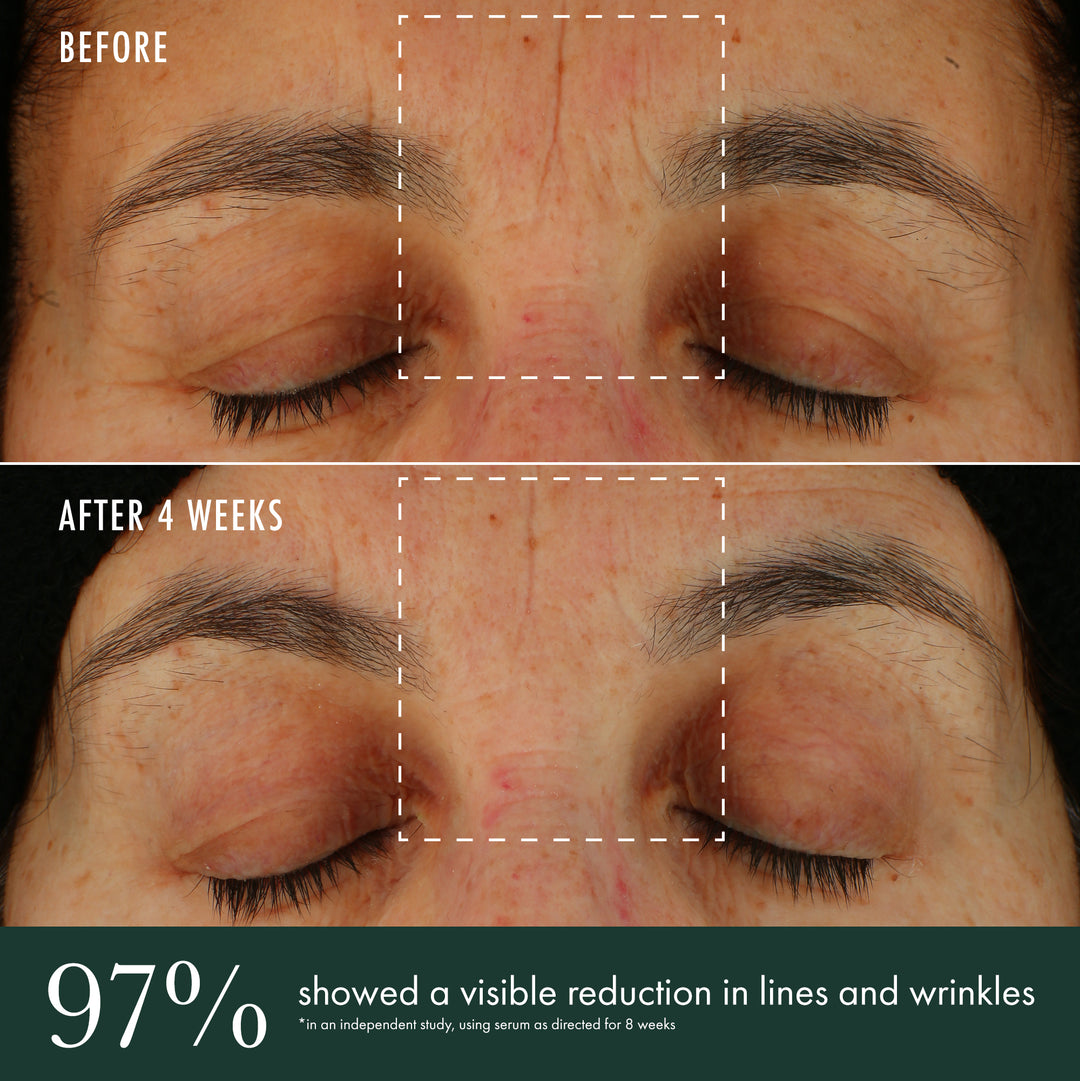 Brightening Serum before & after