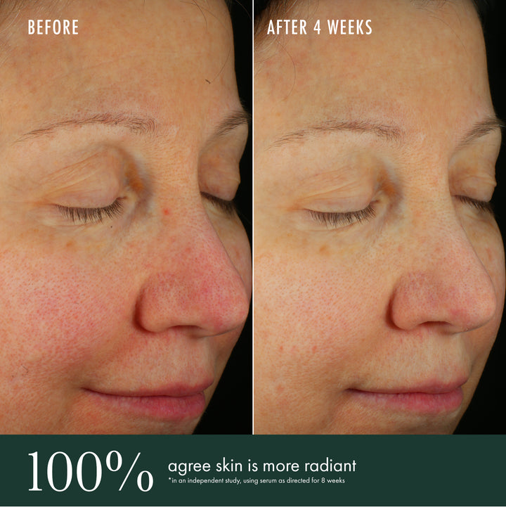 Brightening Serum Before & After