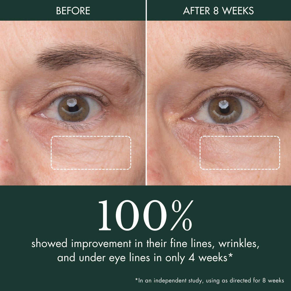 Peau Eye Concentrate Before & After
