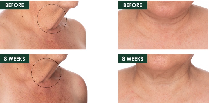 fermitif neck b&a